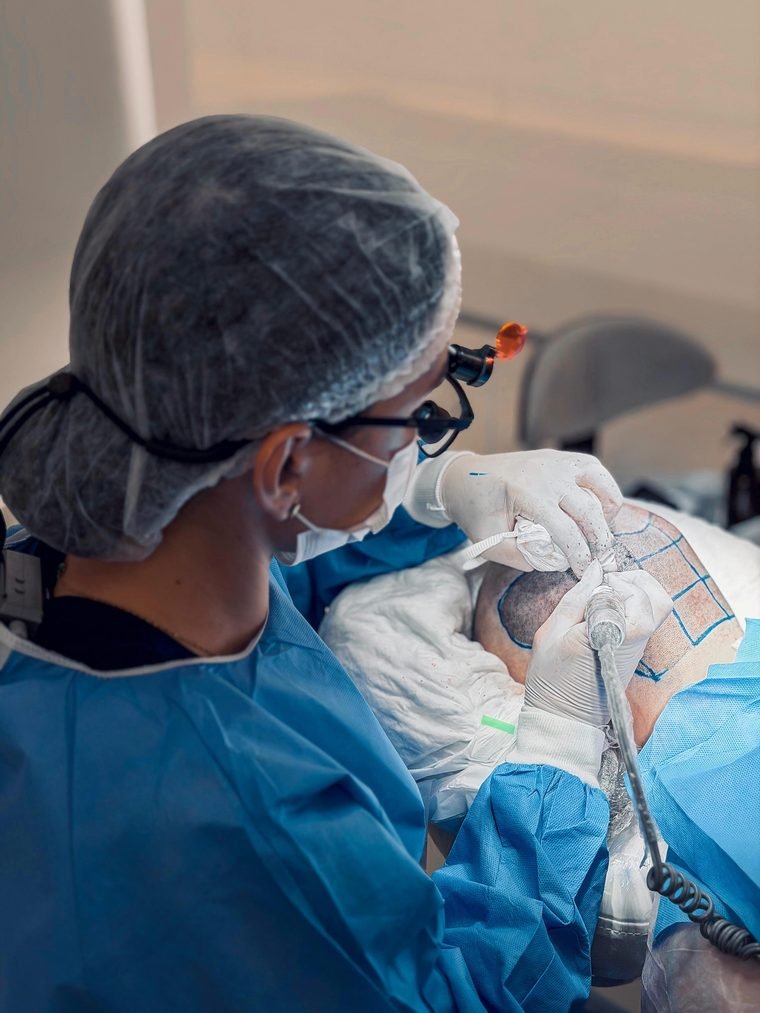 Dra. Juliane Araújo realizando transplante capilar pela técnica FUE